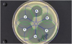 Software Automatically Analyses AST Plates to Give SIR Category