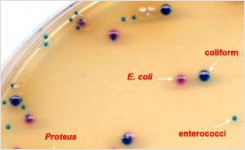 New Thermo Scientific Clarity Agar Improves Differentiation of UTI Pathogens