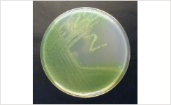 New Thermo Scientific Medium Enhances the Identification of em Pseudomonas aeruginosa em 