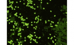 New Cryptosporidium parvum Monoclonal Antibodies