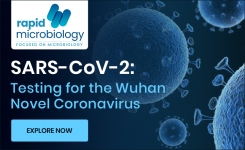 Coronavirus SARS-CoV-2 Test Kits to Detect the Causative Agent of COVID-19