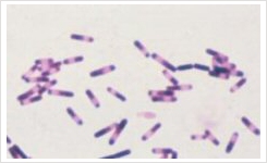  em Clostridioides difficile em Detection and Identification