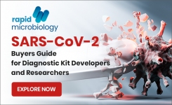 SARS-CoV-2 Buyers Guide for Diagnostic Kit Developers and Researchers incl qPCR reagents and secondary antibodies 