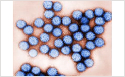 Enteric Viruses Rapid Detection and Identification