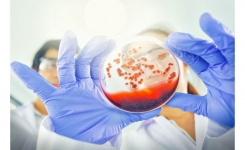 Antibiotic Susceptibility Testing